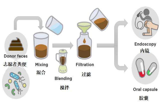 粪菌移植如何操作？粪菌移植过程需要多长时间？这是我们要关注的
